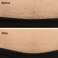 Before and After 