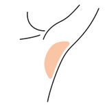 Underarms